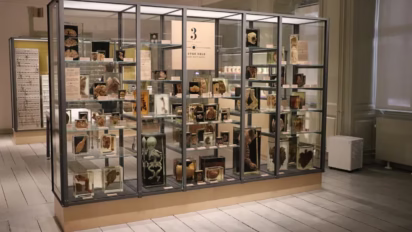 Diseased Organs in the Medical Museion Museum in Copenhagen