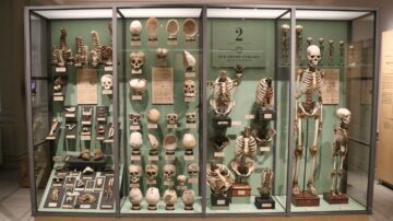 Dry Collection in the Medical Museion Museum in Copenhagen
