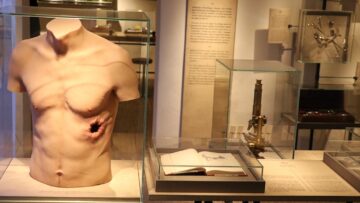 Stomach Fistula Model in the Medical Museion Museum in Copenhagen